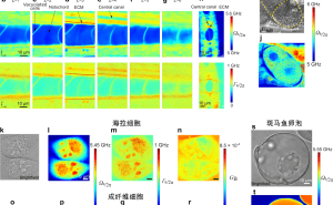 我国科研新突破：全球首台高时空分辨布里渊显微镜研制成功
