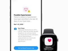苹果watchOS 26更新来袭！旧款Apple Watch也能享高血压警报健康监测