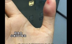 小米SU7电吸门无防夹引风波:车主骨折,安全漏洞敲响行业警钟